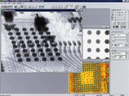 NT-Software für Röntgenbildanalyse